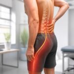 découvrez les causes, symptômes et traitements de la hernie discale centrale responsable de la douleur sciatique, et apprenez à mieux comprendre cette condition pour mieux la gérer.